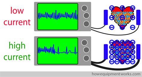 Defibrillator Voltage: How it Works .